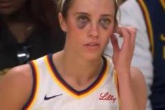 WNBA狂熱前鋒赫爾強(qiáng)度堪比CBA！被“打成熊貓”